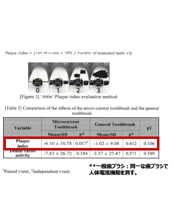 プラクレス